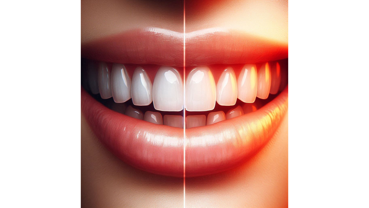 Dental Crowns vs Porcelain Veneers: Which One is Right for You?