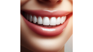 Exploring the Longevity of Dental Veneers: Are They Permanent?